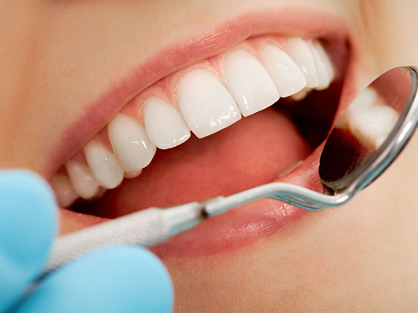 予防歯科のポイント